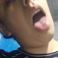 Абайродр Голая