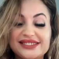 Большие Лабии Девушки Голая