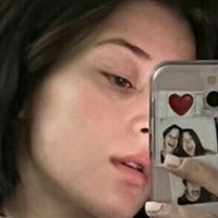 Ицселлексо Голая